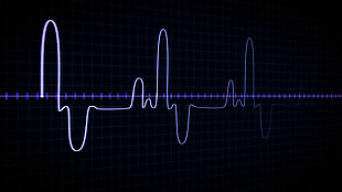 高科技仪表检测心脏速率显示器医疗视频素材